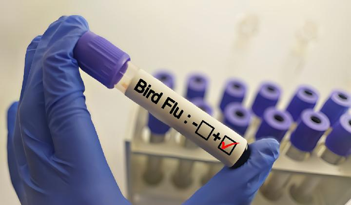 Seorang Pria di Kamboja Meninggal Dunia Akibat Flu Burung H5N1